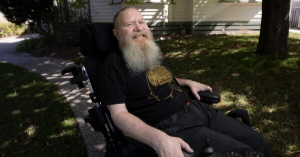 What It’s Like to Have a Brain Implant for 5 Years